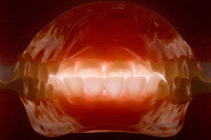 An intra-oral digital dental photograph